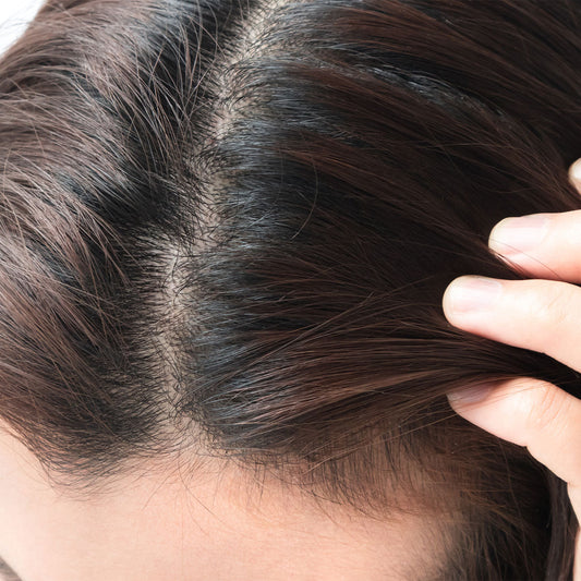 Lifestyle & Ayurvedic Formulas: A Natural Way to Reverse Hair Issues
